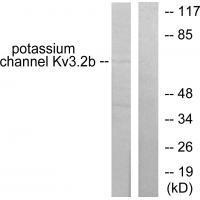 Potassium Channel Kv3.2b Antibody