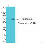 Potassium Channel Kv3.2b Antibody