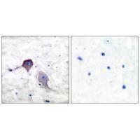 Presenilin 1 Antibody