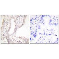 Prostate Apoptosis Response Protein-4 Antibody