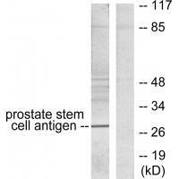 Prostate Stem Cell Antigen Antibody