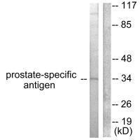 Prostate-specific Antigen Antibody