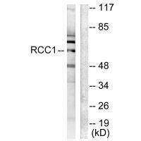 RCC1 Antibody