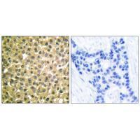 Retinoic Acid Receptor β Antibody