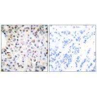 Retinoid X Receptor γ Antibody