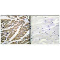 Sodium Channel-pan Antibody