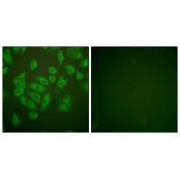 Stefin A Antibody