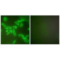 Stefin B Antibody 