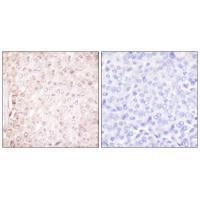 Stefin B Antibody 