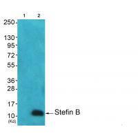 Stefin B Antibody 