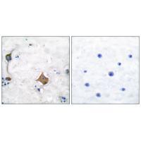 Synaptophysin Antibody