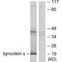 Synuclein γ Antibody