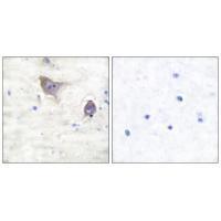 Synuclein β Antibody
