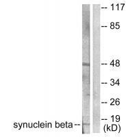 Synuclein β Antibody