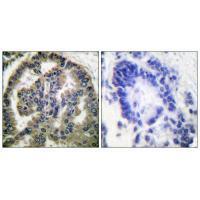 TGF β2 Antibody
