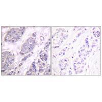 TGF β3 Antibody 