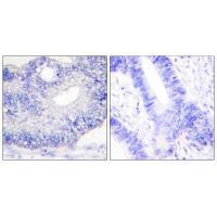TGF alpha Antibody