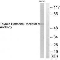 Thyroid Hormone Receptor α Antibody