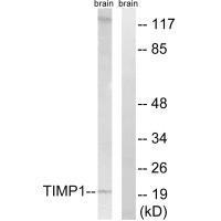 TIMP1 Antibody