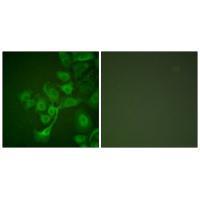 TIMP2 Antibody