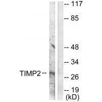 TIMP2 Antibody
