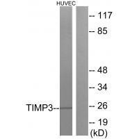 TIMP3 Antibody