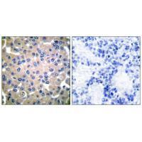 Transglutaminase 2 Antibody