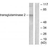 Transglutaminase 2 Antibody
