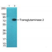 Transglutaminase 2 Antibody