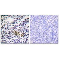 NYREN18 Antibody