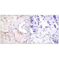PIAS3 Antibody