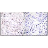 SENP3 Antibody