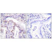 SENP6 Antibody
