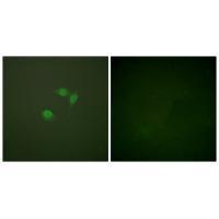 Sumo1 Antibody