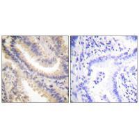 TIMP4 Antibody