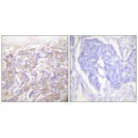 TNF Receptor-1 Antibody