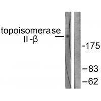 Topoisomerase II β Antibody