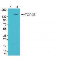 Topoisomerase II β Antibody