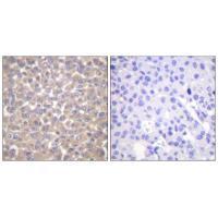 TRADD Antibody 