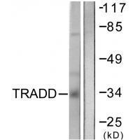 TRADD Antibody 
