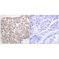 Tubulin γ Antibody