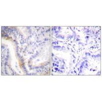 Urocortin Antibody