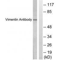 Vimentin Antibody