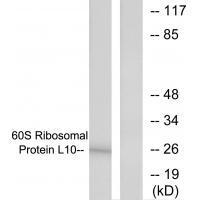 60S Ribosomal Protein L10 Antibody