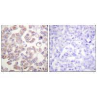 WNT1 Antibody