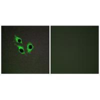 TM16J Antibody