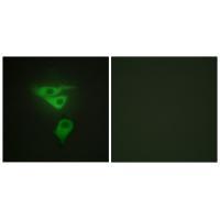 PDLIM1 Antibody
