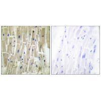 PDLIM1 Antibody