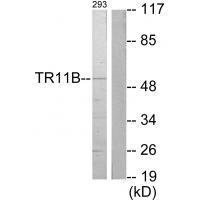 TR11B Antibody