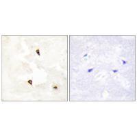 TP53I11 Antibody